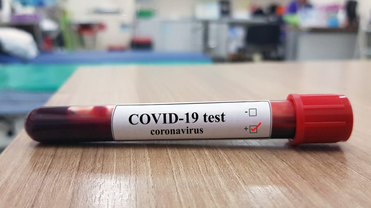 CORONAVIRUS ROMÂNIA, 26 octombrie. 2.844 de noi îmbolnăviri, 79 de persoane au decedat - în ultimele 24 de ore
