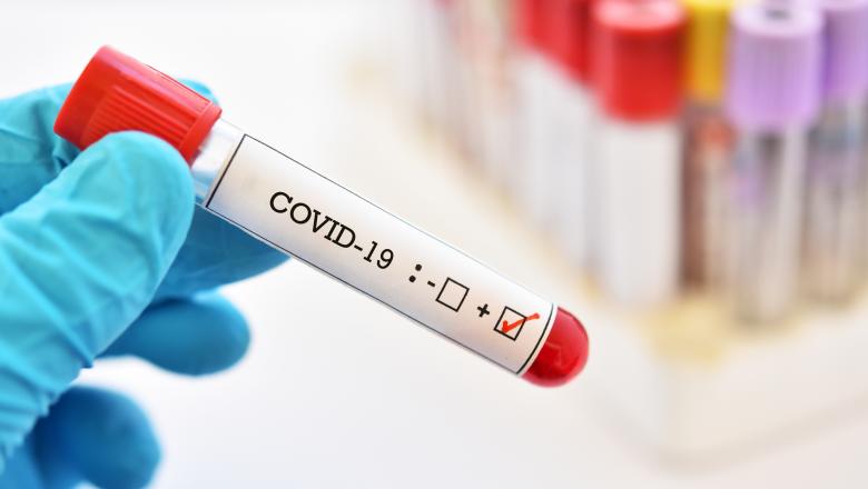 CORONAVIRUS ROMÂNIA, 16 septembrie. 1.713 de noi îmbolnăviri, 49 de persoane au murit - în ultimele 24 de ore