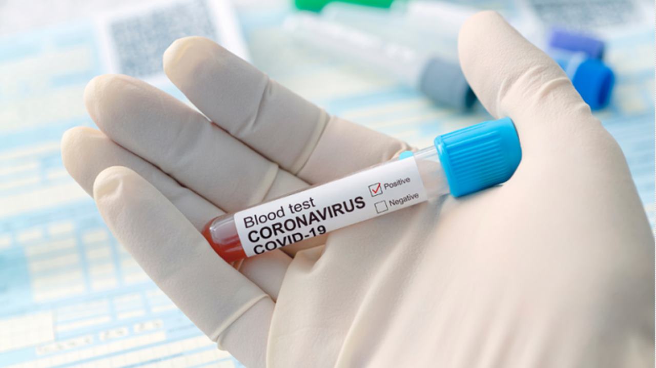 CORONAVIRUS ROMÂNIA, 1 mai. 1.307 de noi îmbolnăviri, 85 de persoane au decedat - în ultimele 24 de ore 