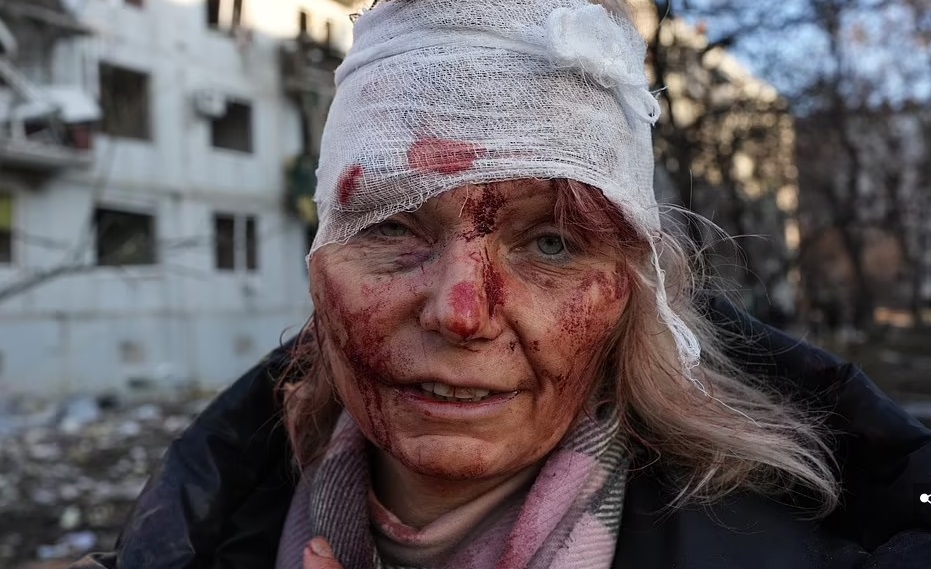 RĂZBOIUL DIN UCRAINA. Morţi răniţi în urma bombardamentelor ruseşti - UPDATE